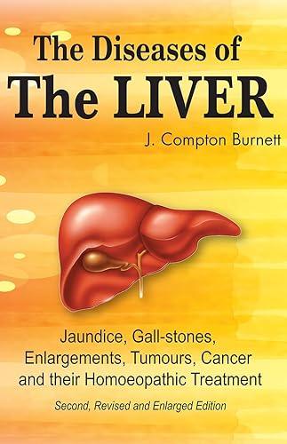 The Diseases of the Liver - Jaundice, Gall-Stones, Enlargements, Tumours, Cancer and their Homeopathic Treatment (Second Revised and Enlarged Edition) by FREE deliverySun