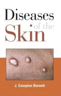 Diseases Of The Skin – Constitutional Nature And Homoeopathic Cure