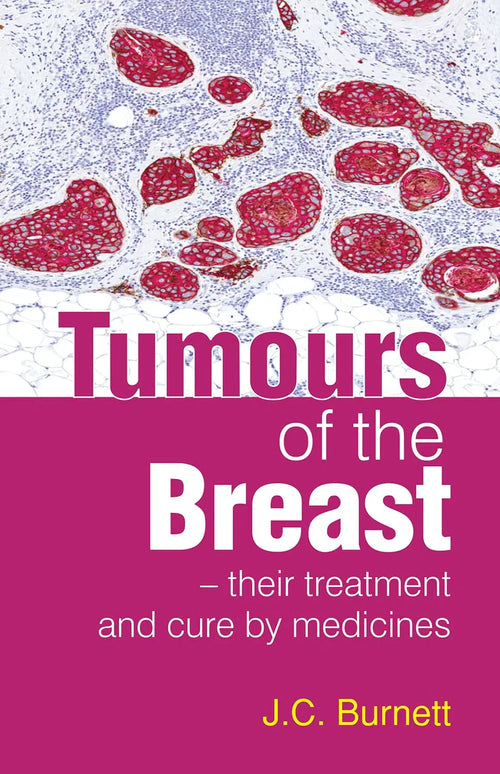 Tumours Of The Breast – Treatment and Cure By Medicine